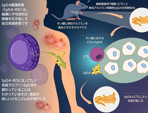原因不明の難病「IgG4関連疾患」における臓器障害のメカニズムを解明<br /