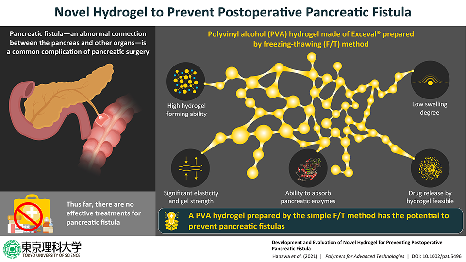 New Study Shows Novel Way to Prevent Postoperative Complication after Pancreatic Surgery