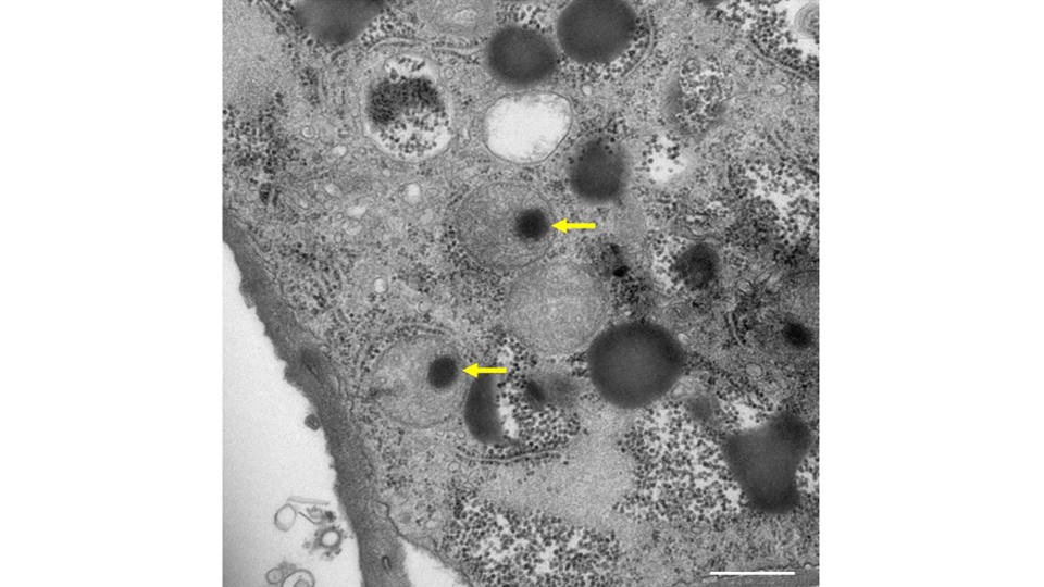 How Giant Viruses Mature: New Evidence from the Medusavirus Sheds Light
