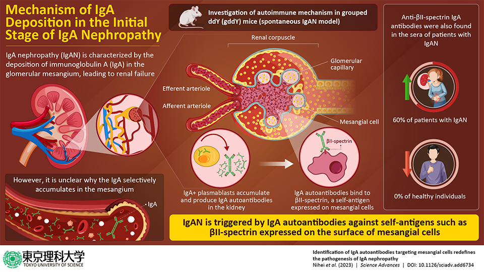 Discovery of Anti-Mesangial Autoantibodies Redefines the Pathogenesis of IgA Nephropathy 