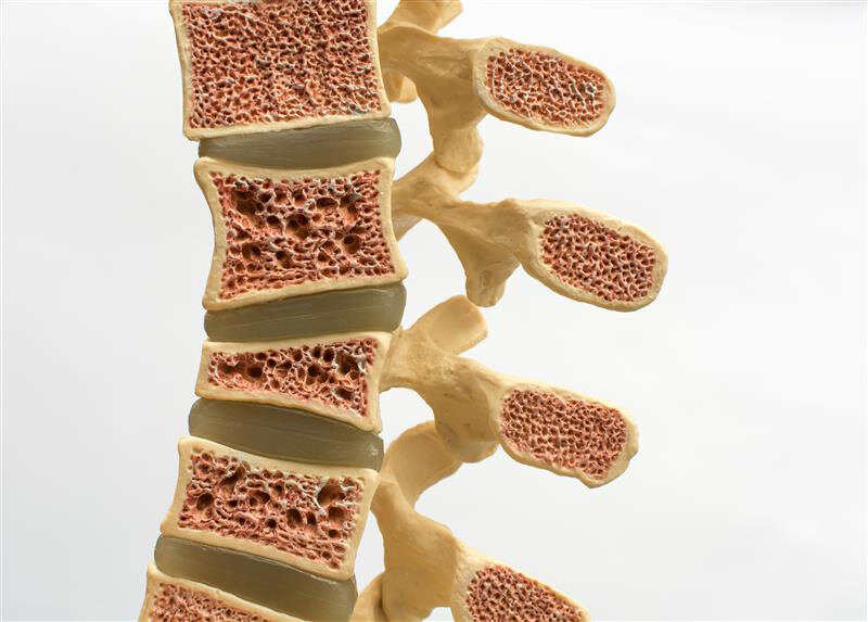 RNA Splicing Regulation Discovery Provides Insight into Bone Diseases