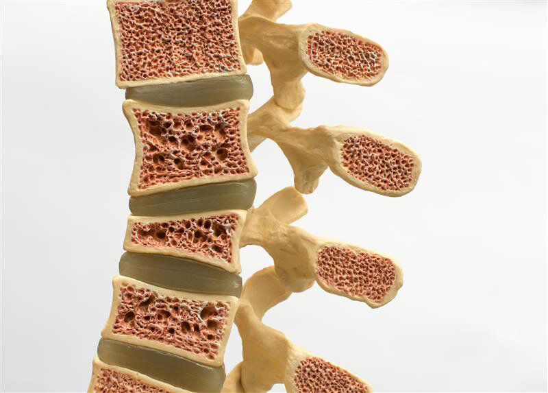 RNA Splicing Regulation Discovery Provides Insight into Bone Diseases 