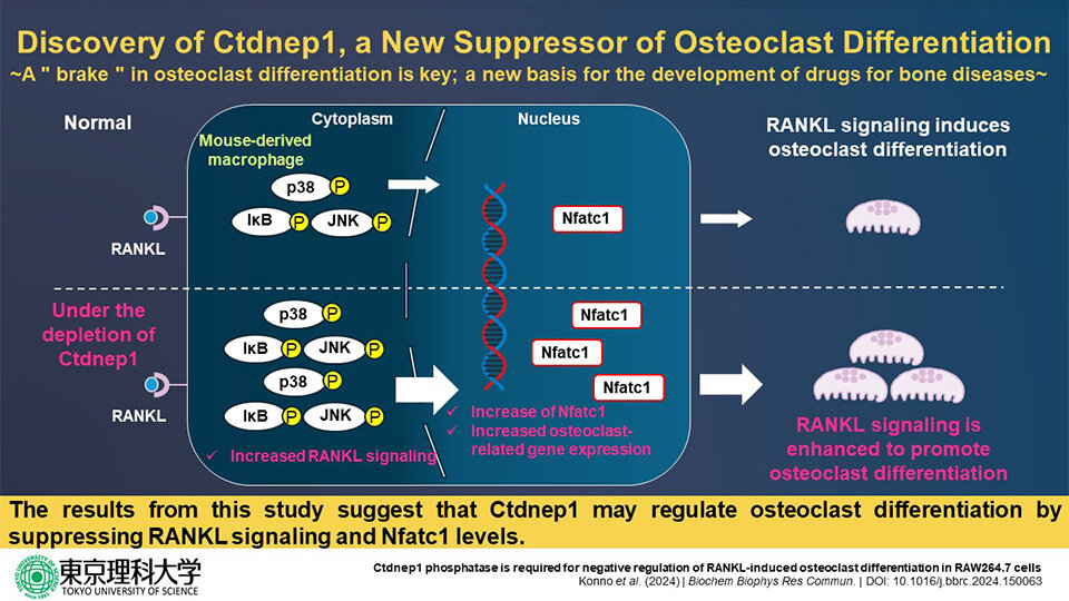 New Study Reveals Key Protein that Could Help Prevent Excessive Bone Loss in Osteoporosis