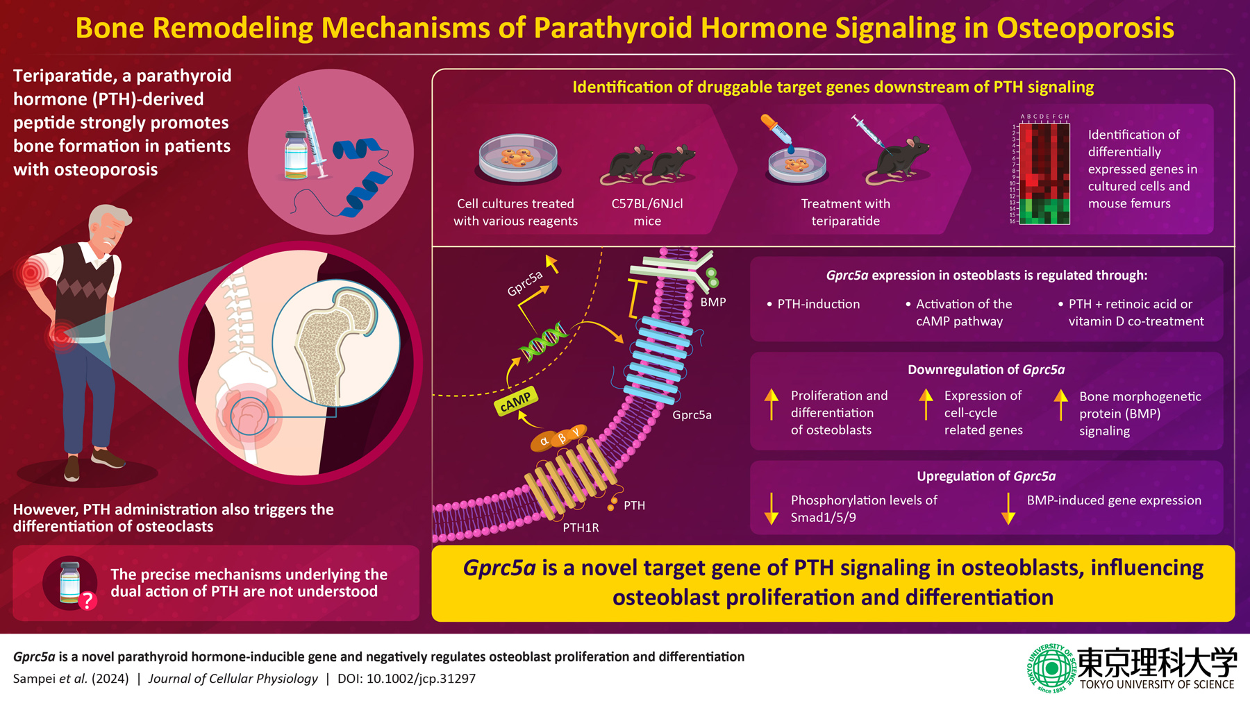 New Study Reveals Promising Drug Target for Treating Osteoporosis