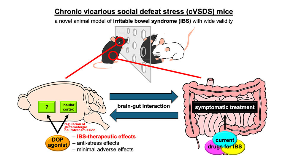 Beyond the Gut: A New Frontier in IBS Treatment by Targeting the Brain