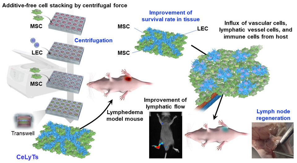 Bioengineered Tissue as a Revolutionary Treatment for Secondary Lymphedema