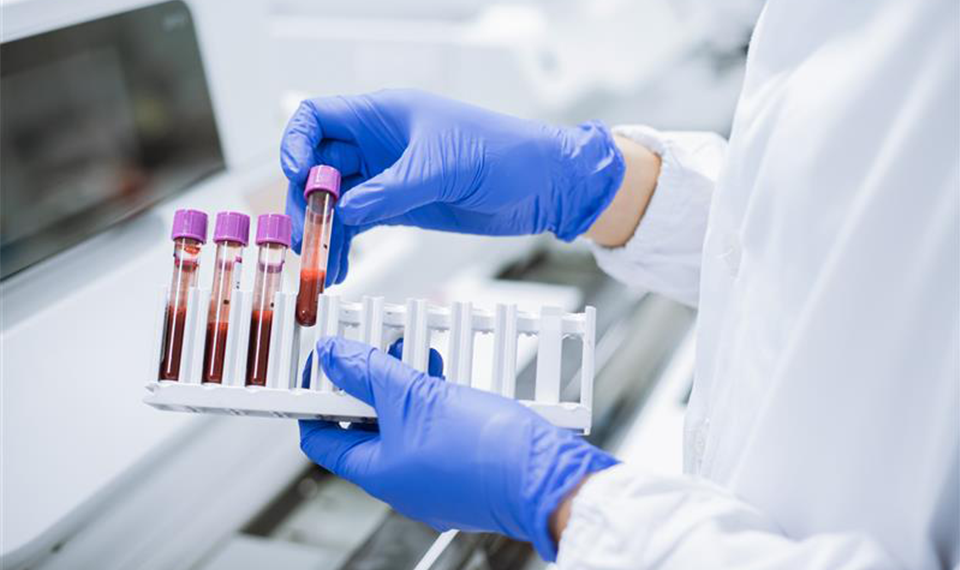 Detecting Alzheimer's with DNA Aptamers--New Tool for an Easy Blood Test