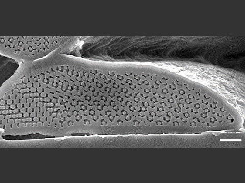 鱗片断面の電子顕微鏡写真