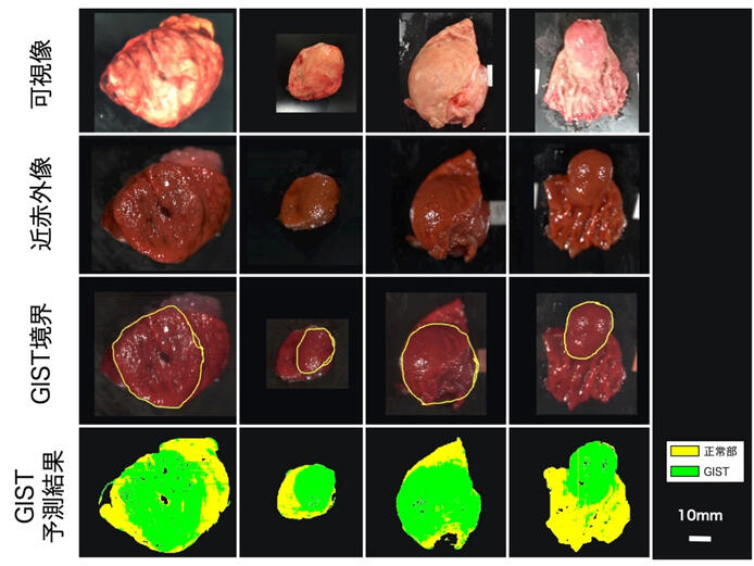 近赤外光を利用したハイパースペクトル画像から粘膜下腫瘍(GIST)を識別～GISTの早期発見、切除部位の最小化につながる画像識別手法の開発に成功～