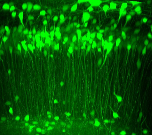 透明化した脳における神経細胞の蛍光イメージング