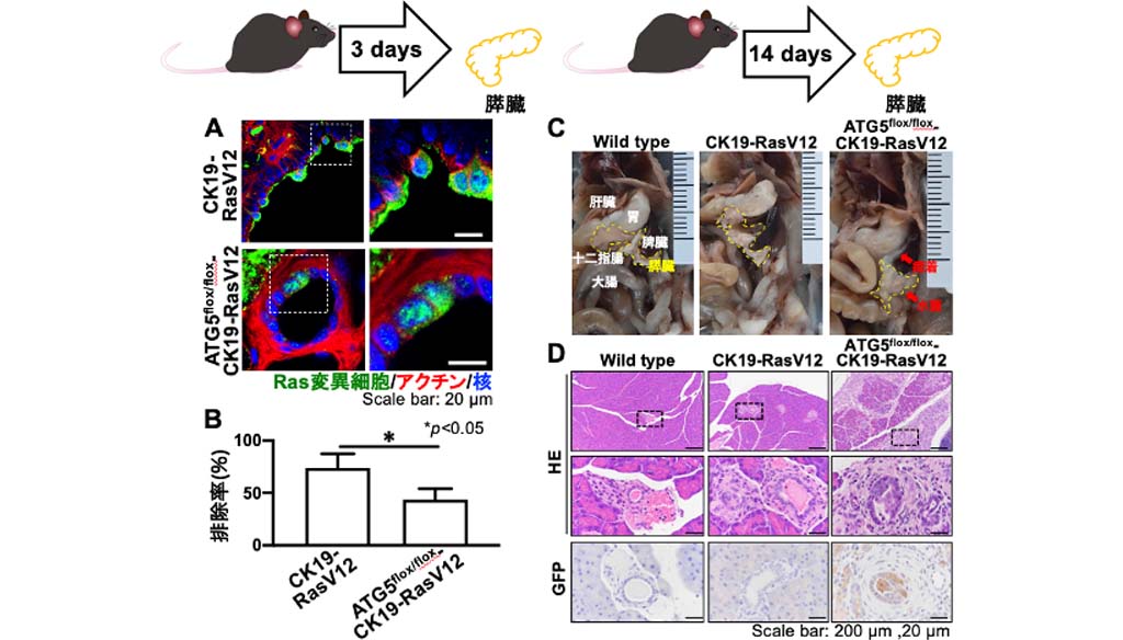 オートファジーががん細胞を排除することを発見、新たながん治療法開発に期待
～細胞競合によるがん細胞除去におけるオートファジーの役割を解明～
