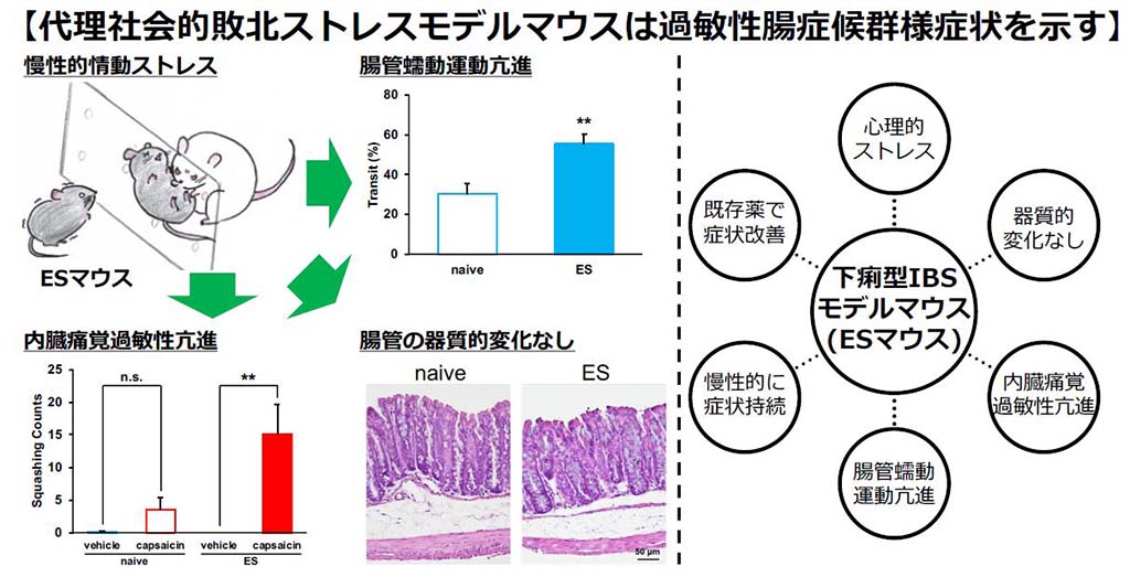 マウスも精神的ストレスで過敏性腸症候群様の症状を示す<br>～過敏性腸症候群のモデル動物としての役割に期待～