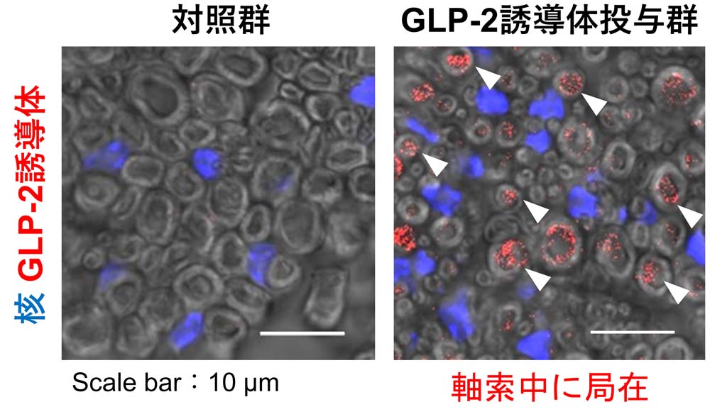 神経科学の既成概念をくつがえす新たな中枢デリバリー技術の作用機序を解明
～経鼻投与された神経ペプチド誘導体が神経細胞を乗り継ぎ脳へ移行する～
