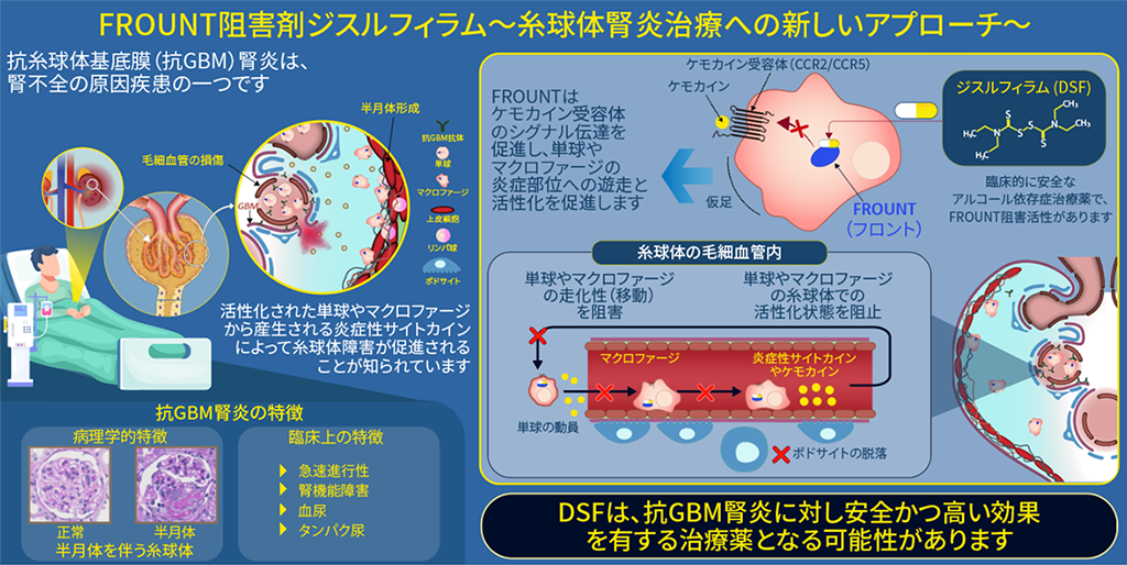 フロント(FROUNT:ケモカイン受容体シグナル制御分子)を阻害する作用をもつアルコール依存症治療薬「ジスルフィラム」が腎臓病の悪化を抑制することを発見~マクロファージの動きと活性化を調節する新しい腎炎治療薬開発への新たな道~
