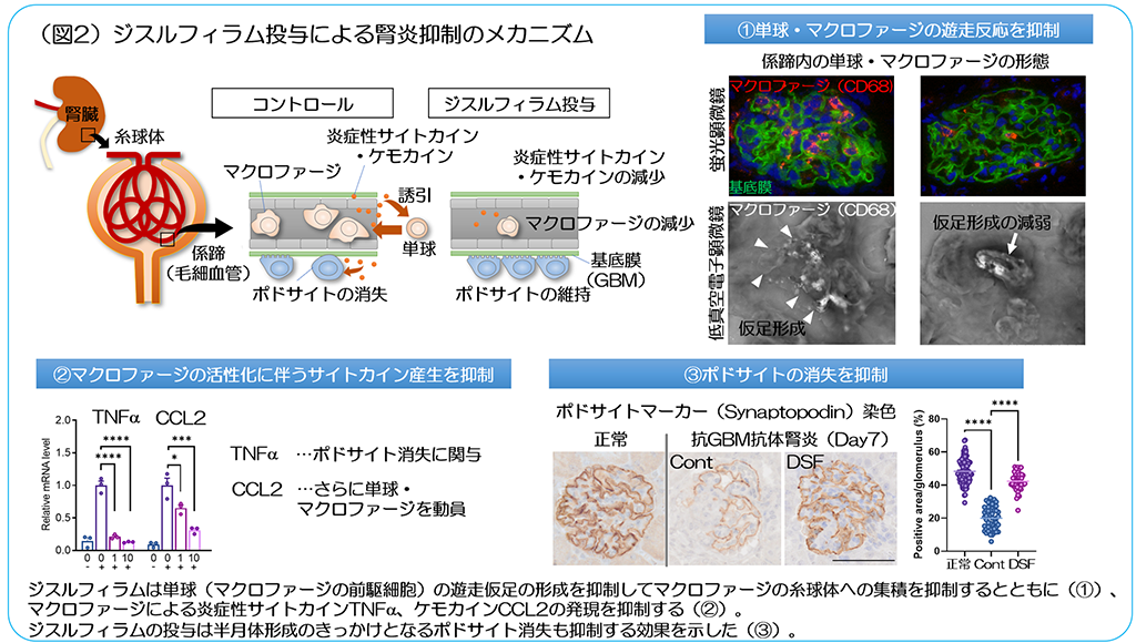 フロント(FROUNT:ケモカイン受容体シグナル制御分子)を阻害する作用をもつアルコール依存症治療薬「ジスルフィラム」が腎臓病の悪化を抑制することを発見~マクロファージの動きと活性化を調節する新しい腎炎治療薬開発への新たな道~