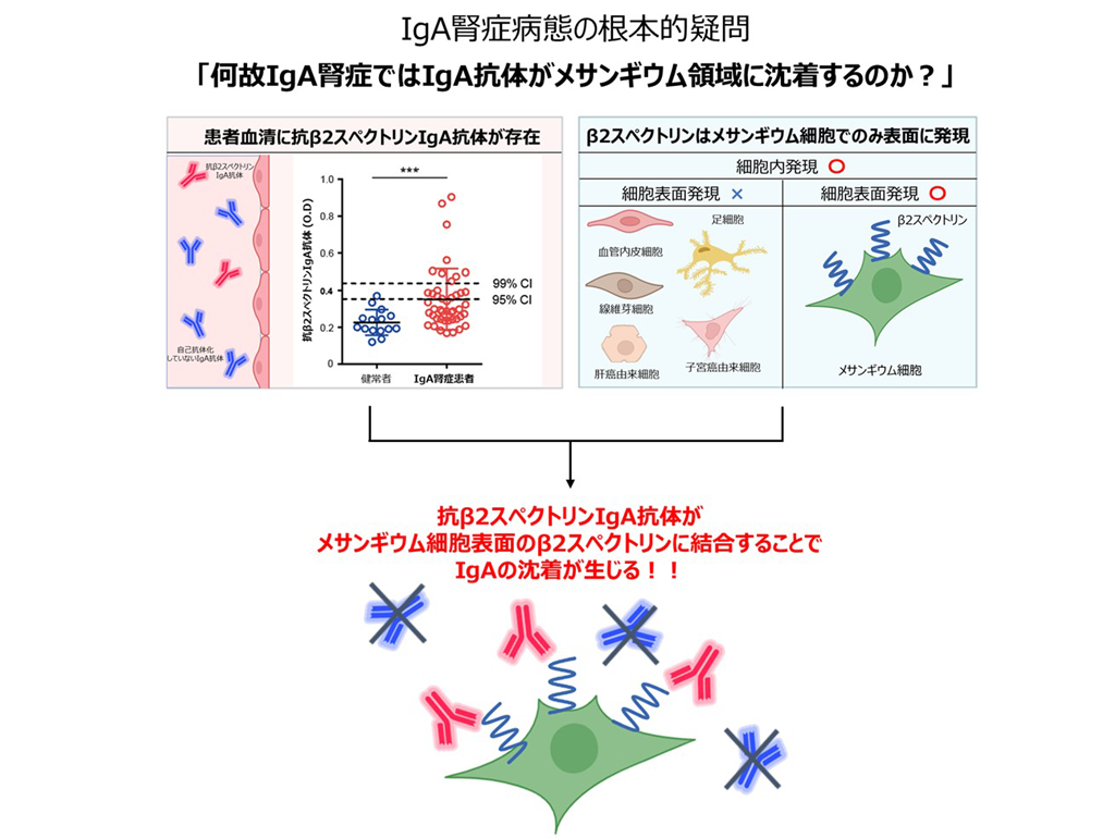 IgA腎症の根治につながる病因を解明～世界初、メサンギウム細胞に対するIgA型自己抗体を発見～～
