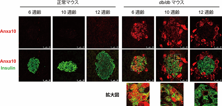 糖尿病発症初期の新しい分子機序を解明