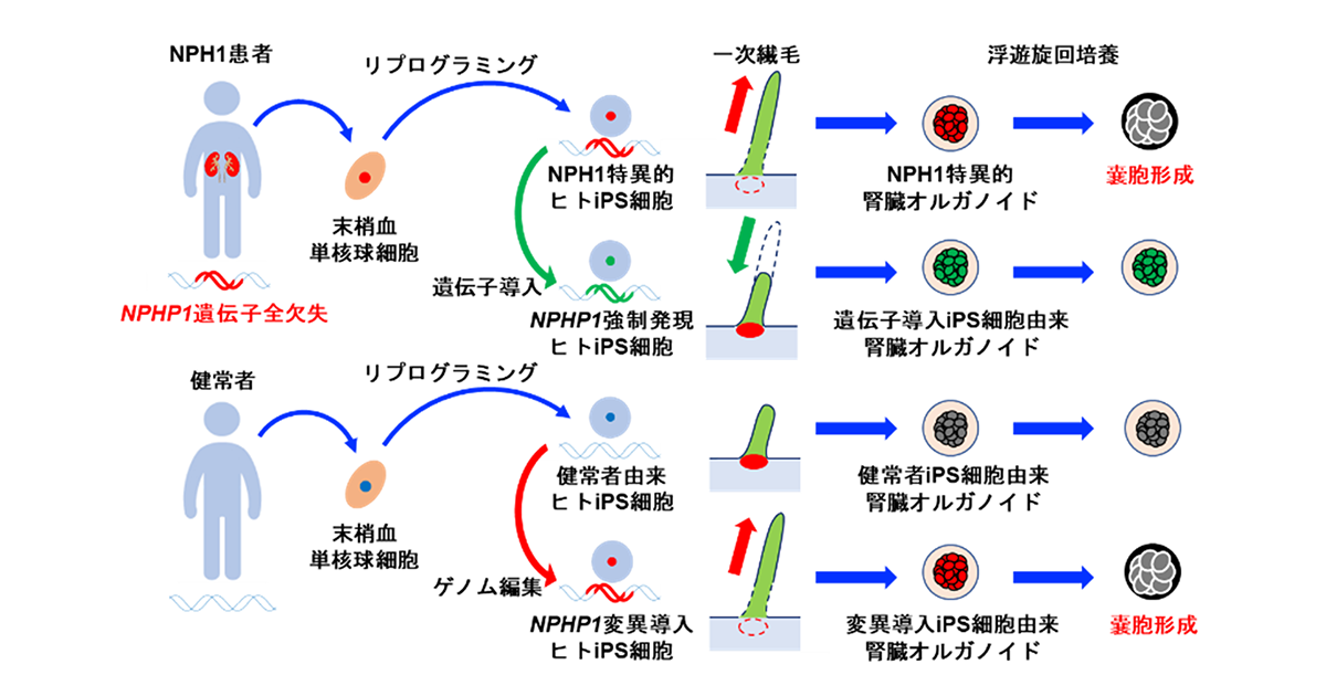 ヒトiPS細胞による若年性ネフロン癆の病態モデリング－遺伝性