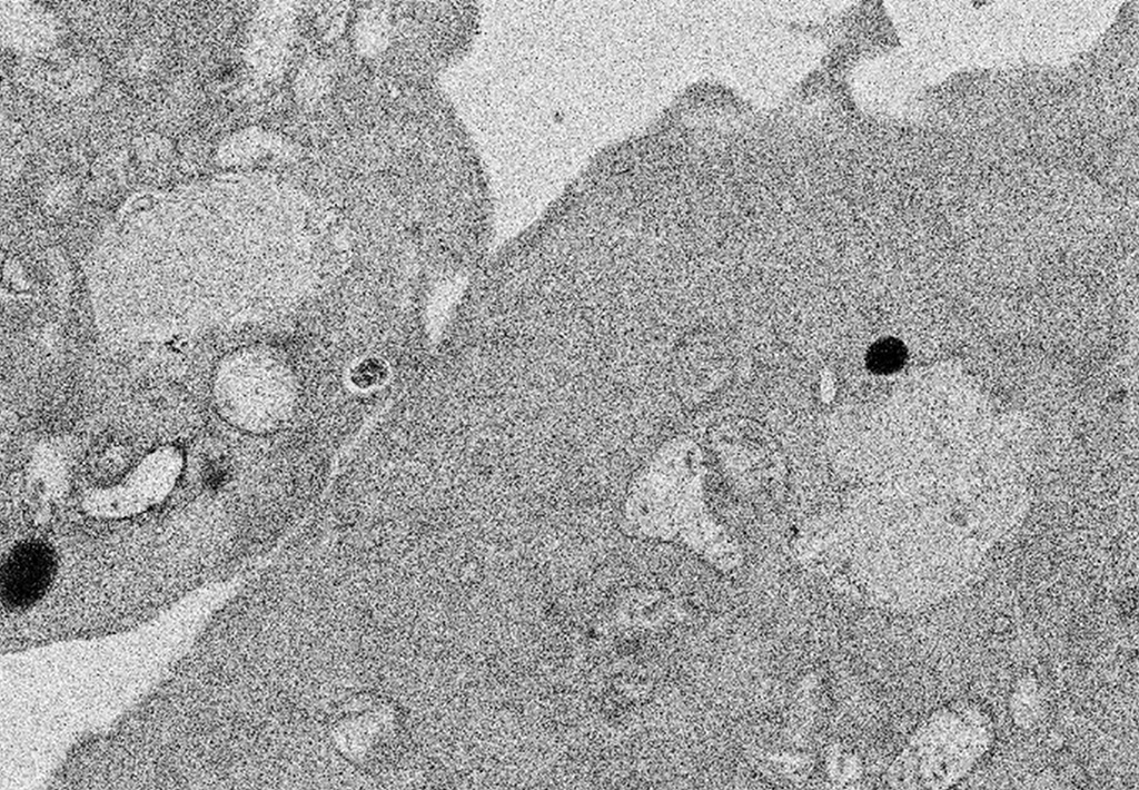 光合成活性を持つ葉緑体を動物細胞に移植することに成功――光合成可能な動物細胞作製の突破口を開く――