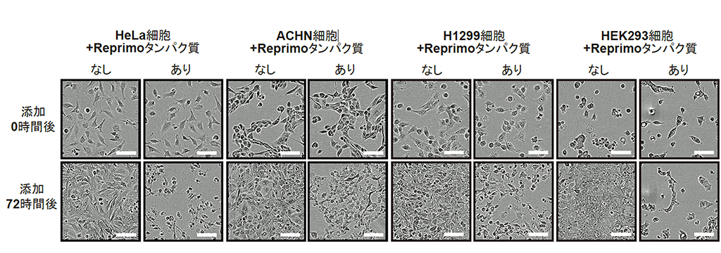 Reprimoタンパク質が細胞外から細胞死を誘導する新規経路を発見 副作用の少ない新薬開発に期待