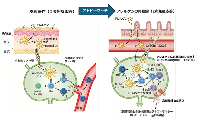  図1. 本研究で示唆されたアトピーマーチの根底にあるメカニズム